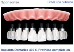 dentier.jpg